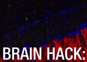 "Creating Memories That Never Happened With Optogenetics" - HP Matter